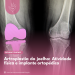 Artroplastia do joelho: Atividade física e implante ortopédico