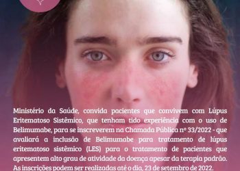 Conitec inscreve pacientes com lúpus e experiência com Belimumabe para contribuir com a perspectiva do paciente