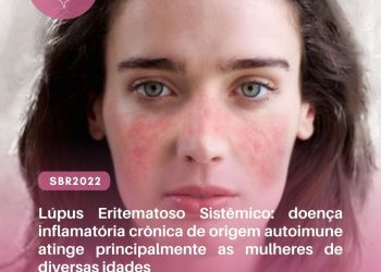 Lúpus Eritematoso Sistêmico: doença inflamatória crônica de origem autoimune atinge principalmente as mulheres de diversas idades