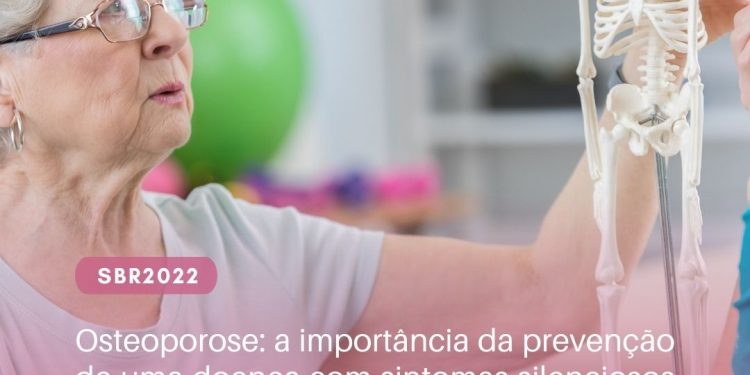 Osteoporose: a importância da prevenção de uma doença com sintomas silenciosos e que ataca principalmente as mulheres