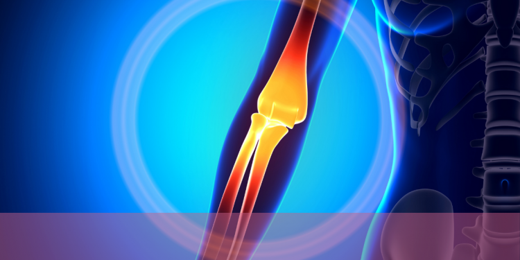 Ciclos de webinários trazem informações sobre a artrite reumatoide e políticas públicas de atenção aos pacientes no SUS