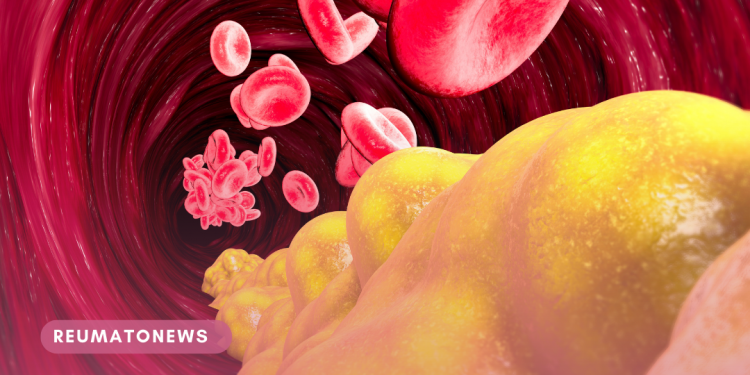 Colesterol: entenda a diferença dos tipos e saiba como se cuidar