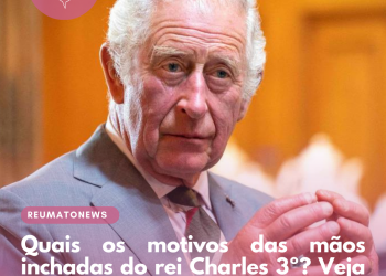Quais os motivos das mãos inchadas do rei Charles 3º? Veja possíveis causas