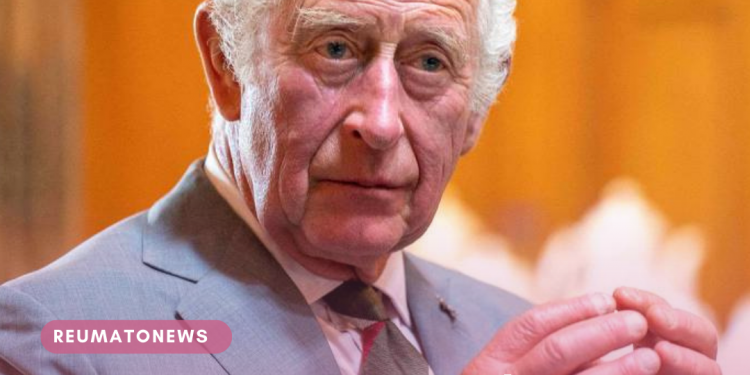 Quais os motivos das mãos inchadas do rei Charles 3º? Veja possíveis causas