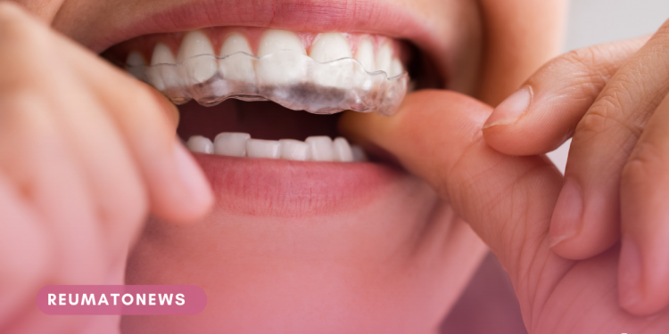 PAUTA – Bruxismo atinge 40% da população; conheça dicas para prevenir o transtorno