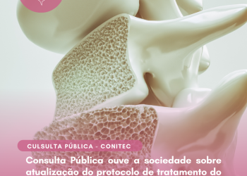 Ministério da Saúde abre consulta pública para atualização do protocolo de tratamento da Osteoporose no SUS