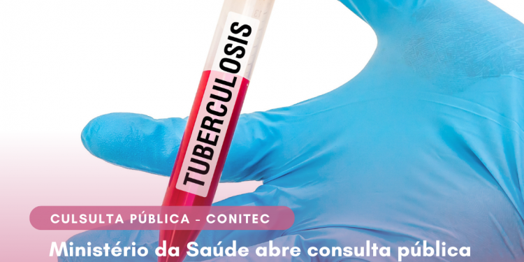 Ministério da Saúde abre consulta pública para ampliação de uso do Teste IGRA para detecção da Tuberculose Latente em pacientes imunocomprometidos