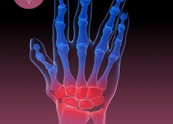 Importância do SUS para os pacientes com artrite reumatoide