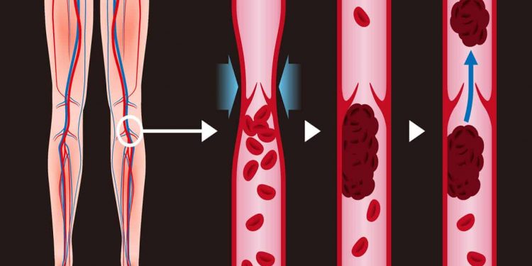 Em carta conjunta, SBD, SBP e ASBAI destacam importância de protocolo clínico e diretrizes terapêuticas para dermatite atópica