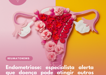 Endometriose: especialista alerta que doença pode atingir outros órgãos da mulher
