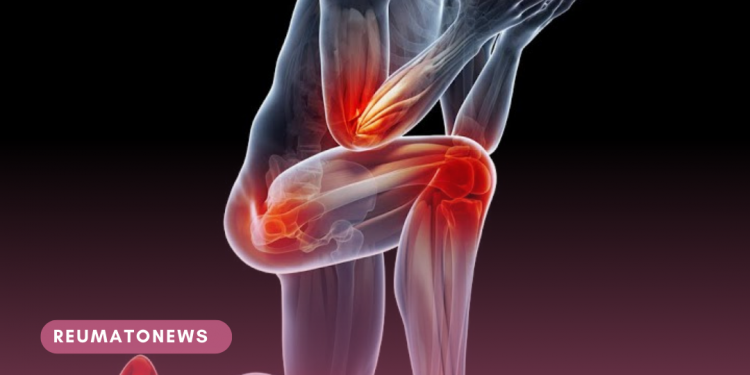 Dia Mundial de Conscientização da Dor: estudo revela que mais de 45% dos brasileiros sofrem de dor crônica no Brasil