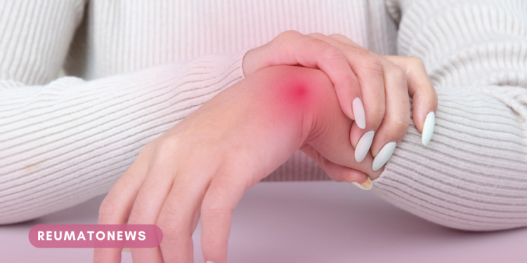 Artrite reumatoide: conheça sintomas, tratamentos e mitos da doença