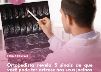 Ortopedista revela 5 sinais de que você pode ter artrose nos seus joelhos