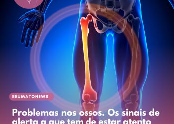 Problemas nos ossos. Os sinais de alerta a que tem de estar atento