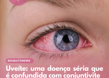 Uveíte: uma doença séria que é confundida com conjuntivite
