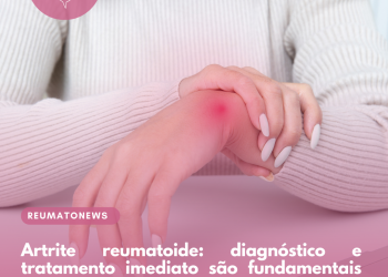 Artrite reumatoide: diagnóstico e tratamento imediato são fundamentais para controle da dor nas articulações