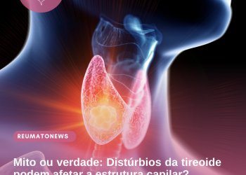 Mito ou verdade: Distúrbios da tireoide podem afetar a estrutura capilar?