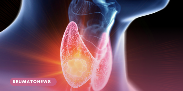 Mito ou verdade: Distúrbios da tireoide podem afetar a estrutura capilar?