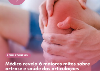 Médico revela 6 maiores mitos sobre artrose e saúde das articulações