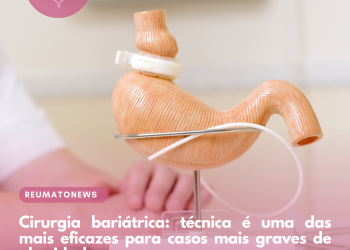 Cirurgia bariátrica: técnica é uma das mais eficazes para casos mais graves de obesidade