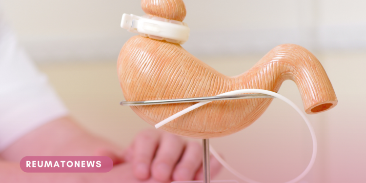 Cirurgia bariátrica: técnica é uma das mais eficazes para casos mais graves de obesidade