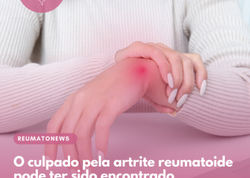O culpado pela artrite reumatoide pode ter sido encontrado