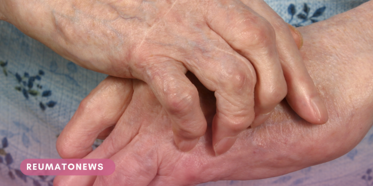 Doenças reumáticas: entenda como buscar o diagnóstico e aliviar a dor