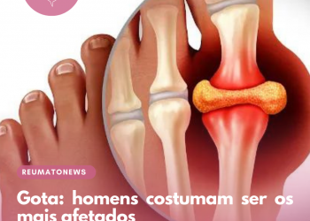 Gota: homens costumam ser os mais afetados