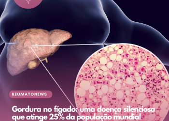 Gordura no fígado: uma doença silenciosa que atinge 25% da população mundial