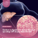 Gordura no fígado: uma doença silenciosa que atinge 25% da população mundial