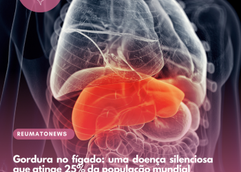 Gordura no fígado: uma doença silenciosa que atinge 25% da população mundial