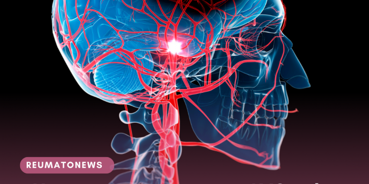 Novo tratamento para o AVC reduz sequelas após a doença