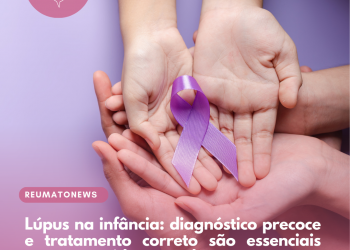 Lúpus na infância: diagnóstico precoce e tratamento correto são essenciais para uma vida normal