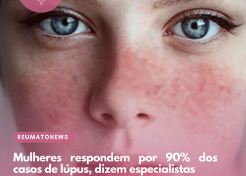 Mulheres respondem por 90% dos casos de lúpus, dizem especialistas