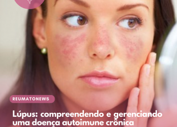 Lúpus: compreendendo e gerenciando uma doença autoimune crônica