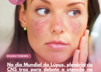 No dia Mundial do Lúpus, plenário do CNS traz para debate a atenção no SUS com o tratamento da doença