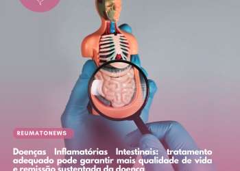 Doenças Inflamatórias Intestinais: tratamento adequado pode garantir mais qualidade de vida e remissão sustentada da doença