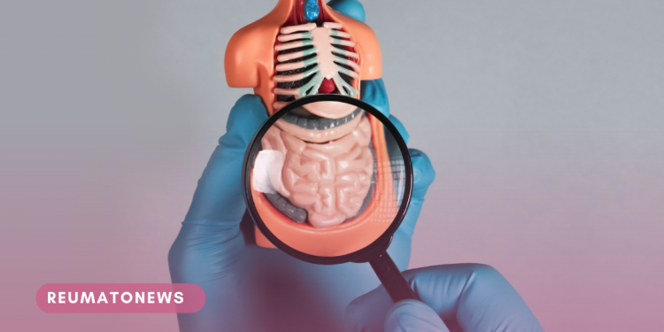 Doenças Inflamatórias Intestinais: tratamento adequado pode garantir mais qualidade de vida e remissão sustentada da doença