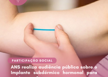 ANS realiza audiência pública sobre o Implante subdérmico hormonal para contracepção