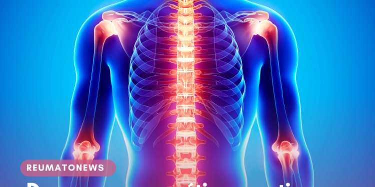 Doenças reumáticas atingem cerca de 15 milhões de brasileiros