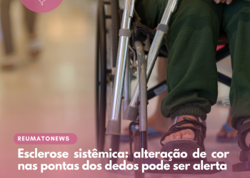 Esclerose sistêmica: alteração de cor nas pontas dos dedos pode ser alerta