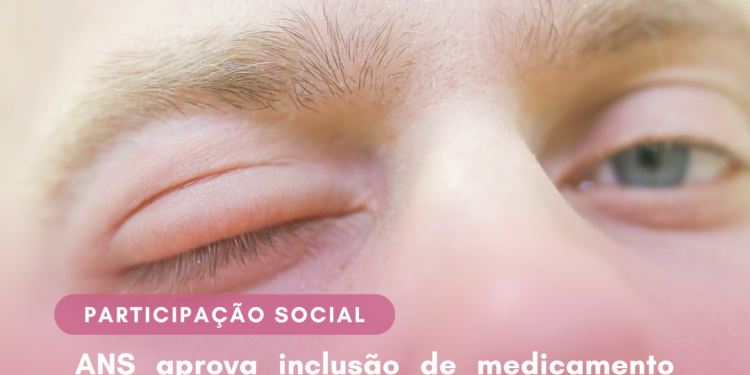 ANS aprova inclusão de medicamento para angiodema hereditário no rol e abertura de consulta e audiência pública para tratamento de câncer e tireoide