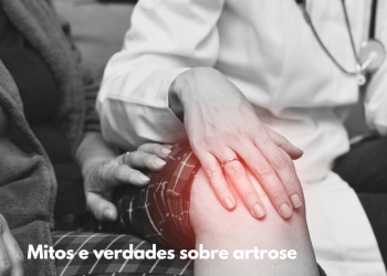 Mitos e verdades sobre artrose