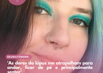 ‘As dores do lúpus me atrapalham para andar, ficar de pé e principalmente sentar’