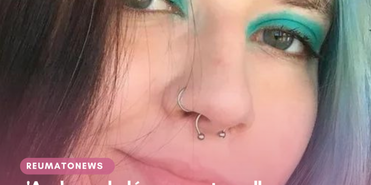 ‘As dores do lúpus me atrapalham para andar, ficar de pé e principalmente sentar’