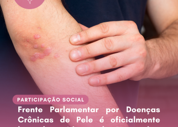 Frente Parlamentar por Doenças Crônicas de Pele é oficialmente lançada na Câmara dos Deputados