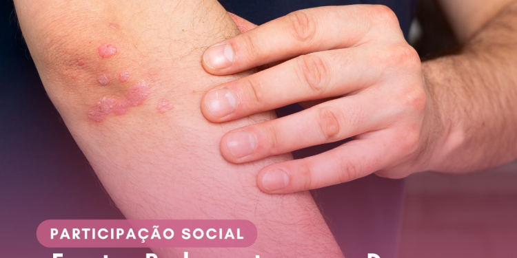 Frente Parlamentar por Doenças Crônicas de Pele é oficialmente lançada na Câmara dos Deputados