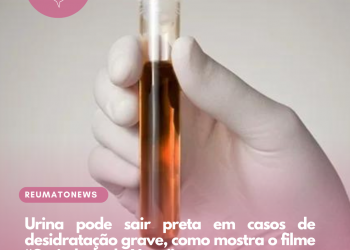 Urina pode sair preta em casos de desidratação grave, como mostra o filme “Sociedade da Neve”