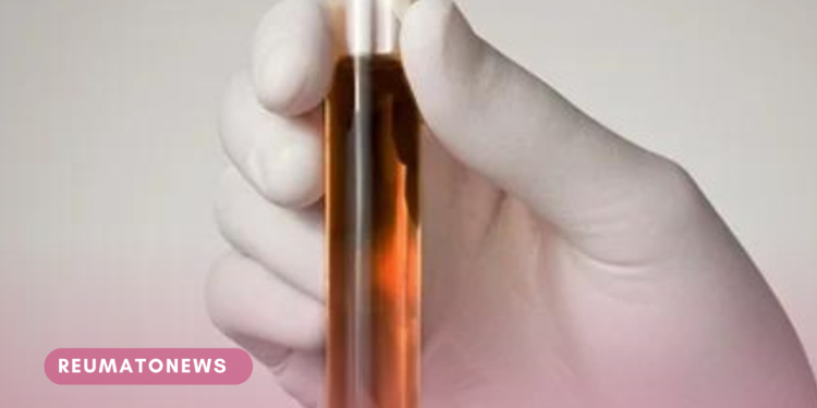 Urina pode sair preta em casos de desidratação grave, como mostra o filme “Sociedade da Neve”