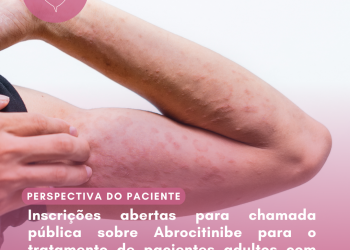 Dermatite Atópica: Abrocitinibe/Perspectiva do Paciente – Conitec